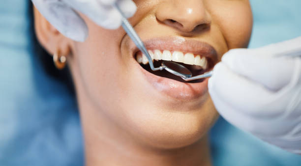 Best Emergency Dental Care for Broken or Chipped Teeth in Edna, TX